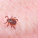 how to prevent a tick bite